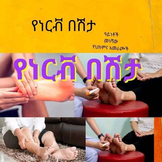 ነርቭ መልዕክት ከተለያዩ የሰውነታችን ክፍሎች ወደ አንጎልና ህብረ ሰረሰር የሚያመላልስ የሰውነታችን የኤሌክትሪክ ሽቦ ነዉ