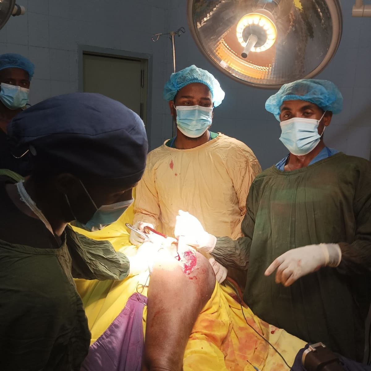 በሆስፒታላችን የመጀመሪያ የሆነው የግማሽ ዳሌ መገጣጠሚያ ቅየራ