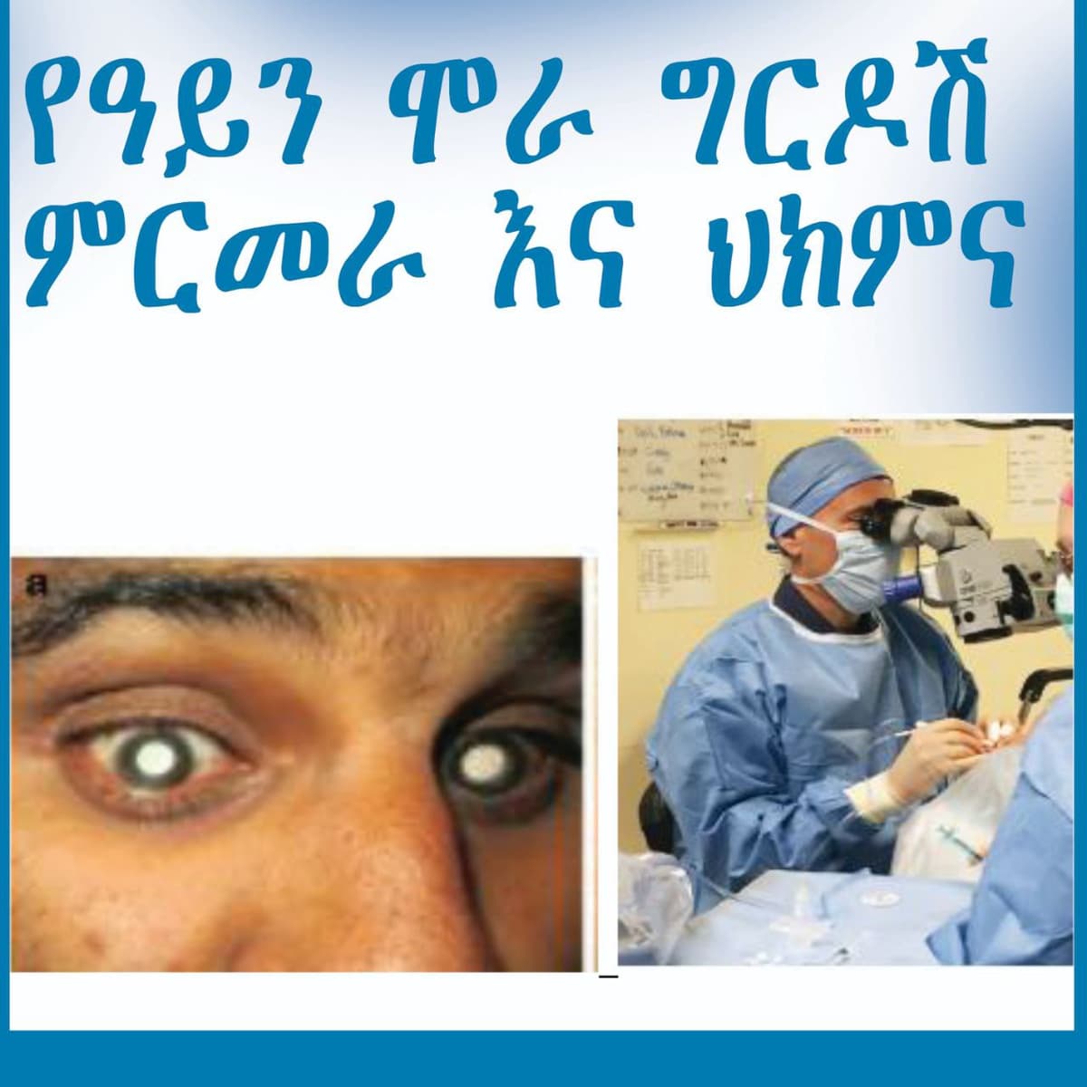 የዓይን ሞራ ግርዶሽ